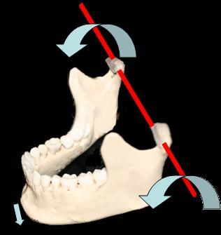 BIOMECHANICS OF MANDIBULAR MOVEMENTS Temporomandibular Joints: Ginglymoarthrodial joint Hinging