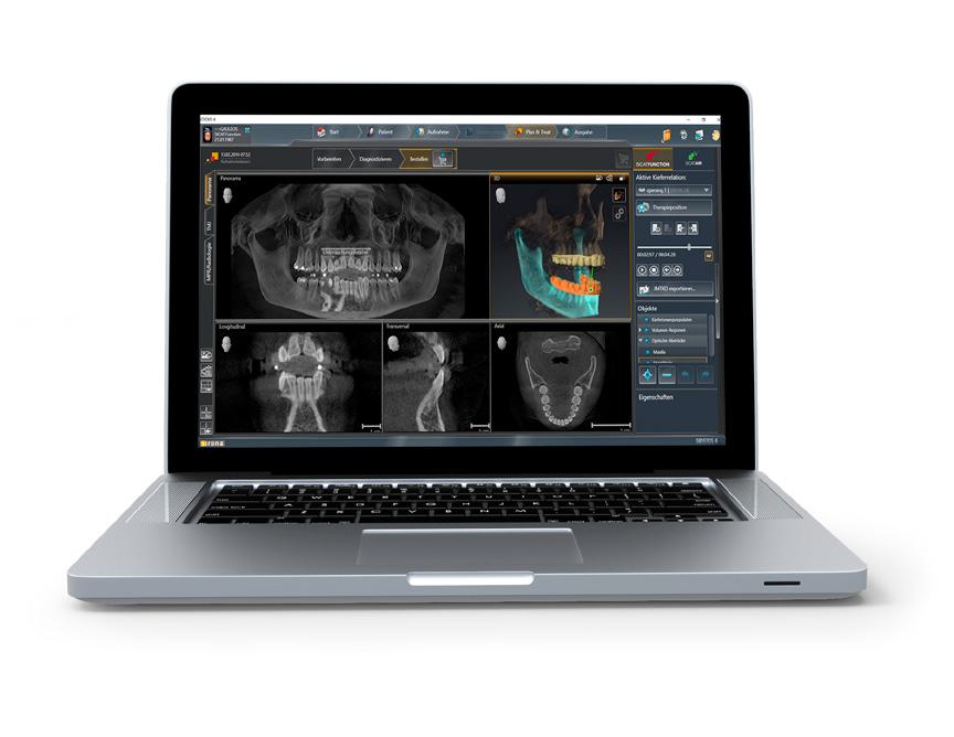 SICAT FUNCTION introduces an integrated 3D workflow for diagnostics and therapy of temporomandibular dysfunctions (TMD).