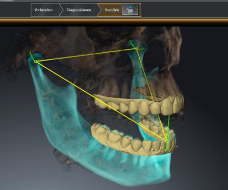 TRACK REAL MOTION IN MOTION THE DATA MERGED IN SICAT FUNCTION allows for the first time a patient-individual 3D display of the mandible and teeth in motion for the first time.