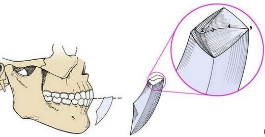 Mandibular Movement Posselt s 3D envelope of mandibular border movement 1- Mandibular incisors track along the lingual concavity of the maxillary