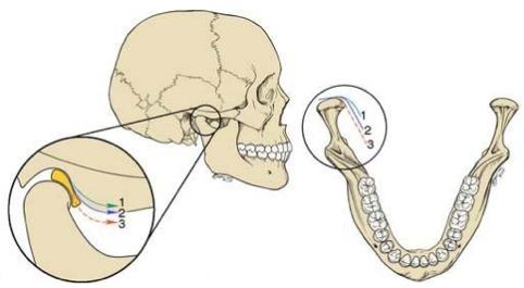 Anatomic Determinants of Mandibular Movement Anterior