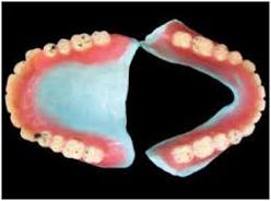 Concepts of Occlusion Artificial dentition Bilaterally balanced