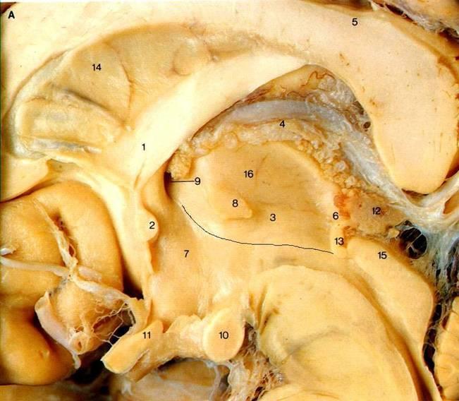 Anterior commissure: connects the inferior and middle temporal gyri &