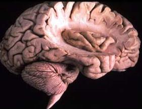 Temporal lobe: Superior & inferior temporal sulci giving rise to superior, middle & inferior temporal gyri.