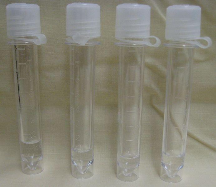 CEREBROSPINAL FLUID CULTURE + other normally sterile fluids e.g.