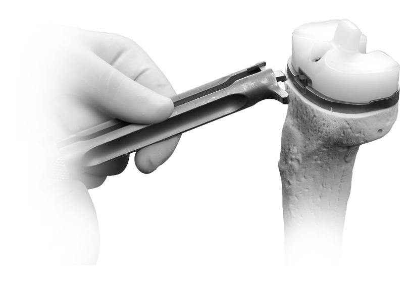 Impactor will not engage the NexGen Trabecular Metal Tibial Tray with the articular surface in place. Fig. 25 Use the 95 in-lb Torque Wrench attached to the 4.