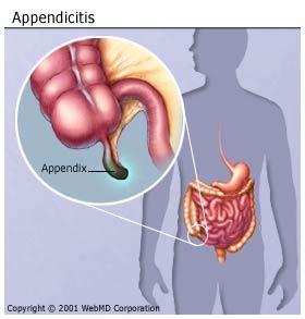 Digestive Tract: Caecum & Appendix Appendix: -blind-ended tube -believed to shelter