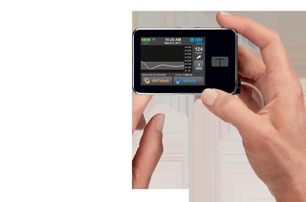 TANDEM DIABETES CARE Technology for Simply Better Life Only touchscreen interface, remote updatable, intuitive platform with contemporary style and compact size Nearly 56,000 pumps shipped in the