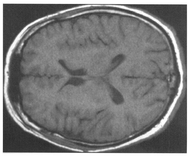 How MRI