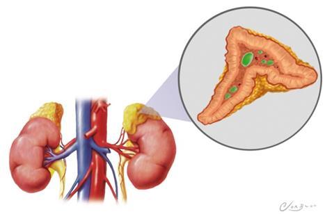 adrenal gland which lies on the kidney. Aldosterone promotes the absorption of Na + by the kidneys.