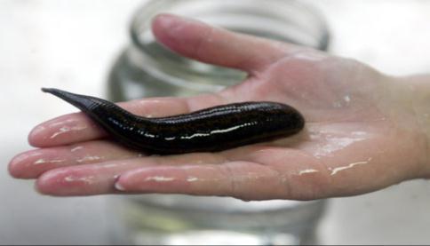 leeches have salivary glands that produce a chemicals known a hirudin which prevents the host s blood
