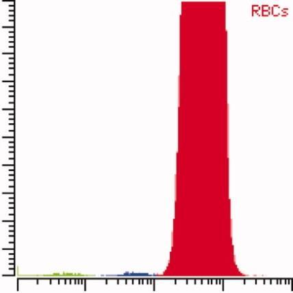 Count Type III 0.0% Type II 0.0% Type I 100% Normal RBCs with normal CD59 expression (Type I cells) CD59-PE Type III 6% Type II 0.