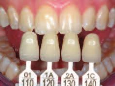 Shade determination of the natural tooth After tooth cleaning, the tooth shade of the non-prepared tooth and/or the adjacent teeth is determined