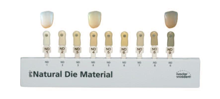of the IPS Natural Die Material shade guide. This allows the clinician to select the appropriate IPS e.