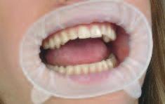 moisture control in the oral cavity.