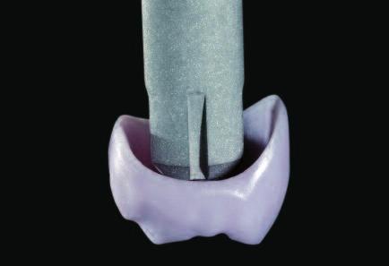 Preparing the restoration for Combination Firing Larger restorations (partial crowns and crowns) made of IPS e.max CAD must be secured on a Crystallization Pin with IPS Object Fix Putty of Flow.