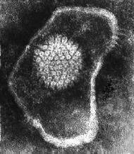 Chicken Pox and Shingles All look the same under electron microscope Enveloped double stranded DNA viruses.