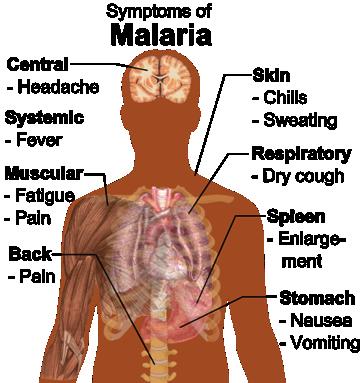 Clinical Presentation In the early stages, malaria symptoms are