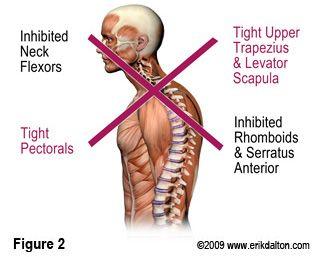 What Causes Shoulder Pain? 1. Impaired posture 2. Altered stroke technique 3.