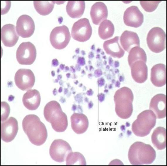 Thrombocytes - Platelets Smallest cell in the blood Do not contain a