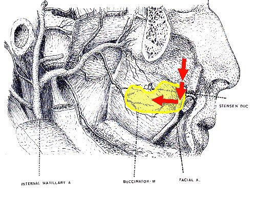Figure 9: Preserved facial artery Superiorly Based Buccinator Flap This is a reversed-flow flap based on the facial artery and its anterior buccal branches (Figure 10).