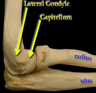 Complications; (1) Vascular injury (2) nerve injury mainly medial & ulnar nerve (3) elbow stiffness, these # always result in some degree of elbow stiffness (4)heterotopic ossification (myositis