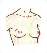 Treatment Options Why do I need surgery? Surgery is used to remove the cancerous area from the breast.