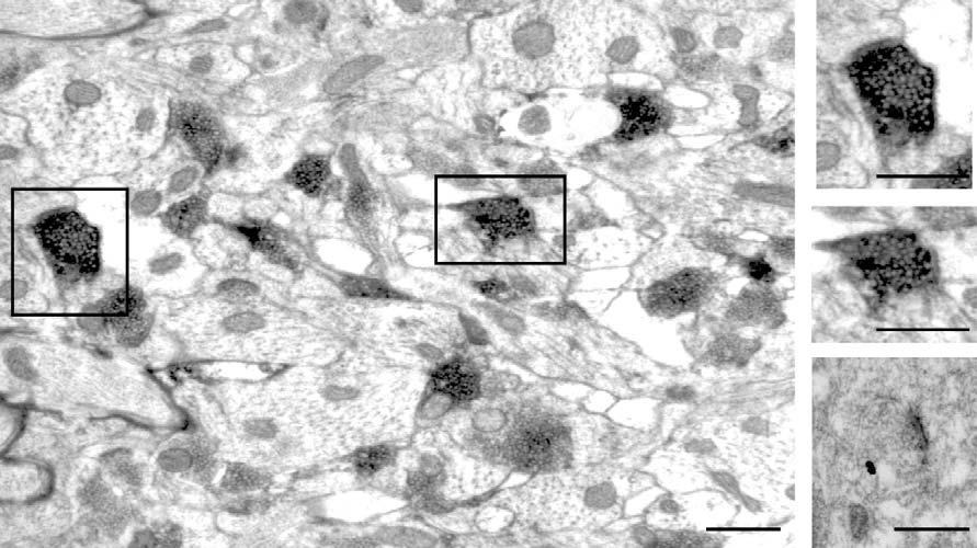 Supplementary Figure 2: Wide-spread distribution of syb2 in synaptic terminals in the stratum radiatum of the CA1 area. Electron micrographs showing immunoreactivity for syb2 in the str.