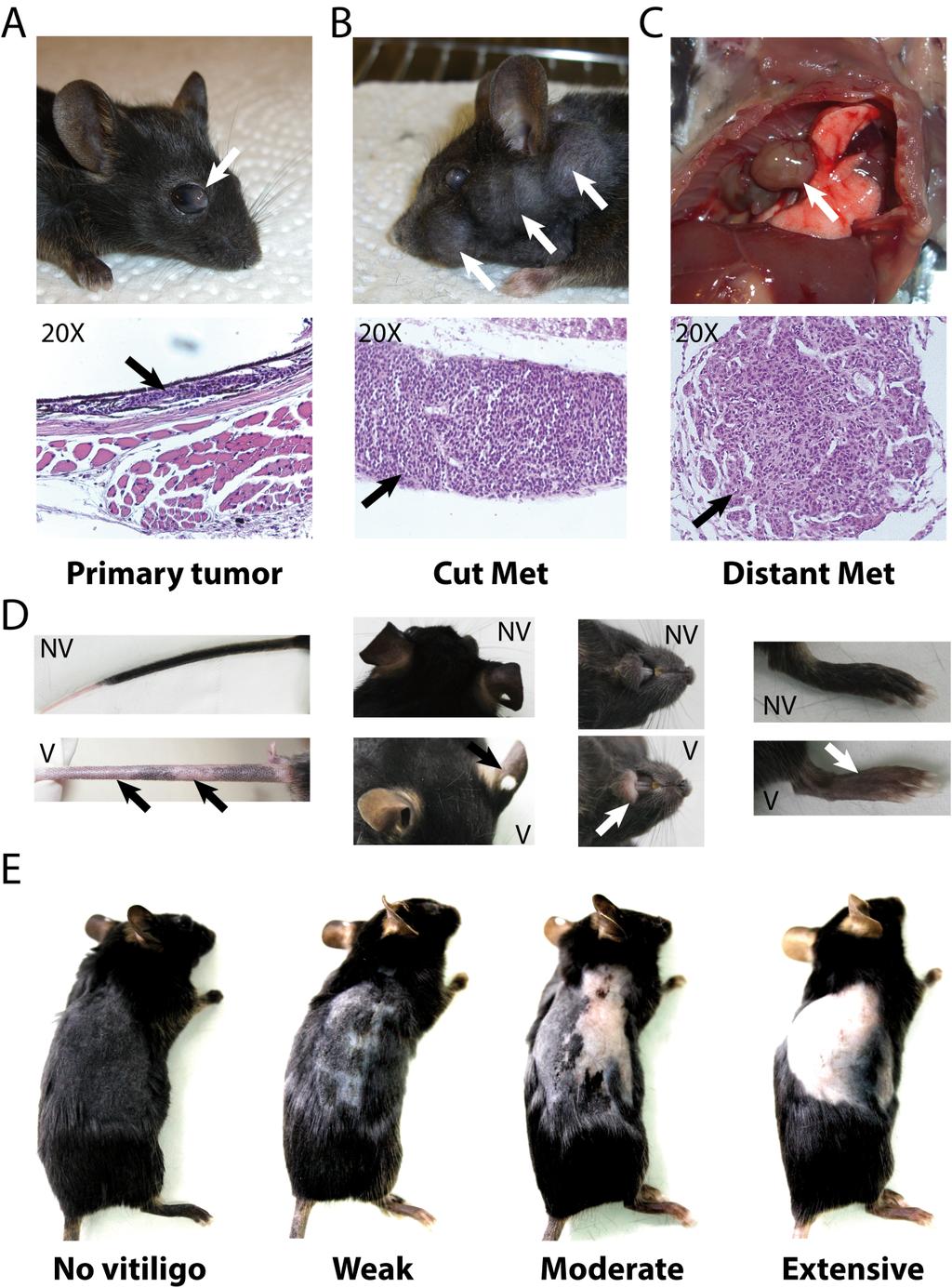 Figure S1: Diagnosis of MT/ret mice.