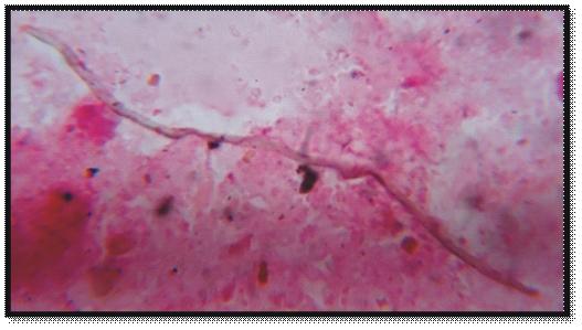 Mukherjee, De and Sardar 184 X 1 Fig. 4. Photomicrograph nematode (Strongyloides sp.