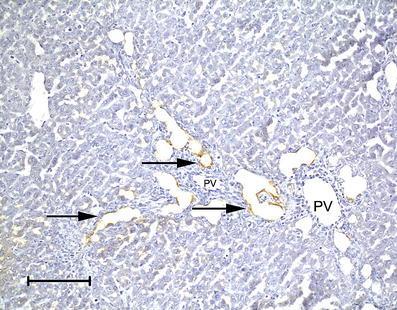 Biliary Atresia: Viral Infection Liver section from RRV-infected
