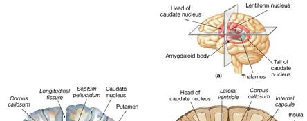 and proximal limb muscles Anterior view Basal Nuclei The basal nuclei are masses of gray