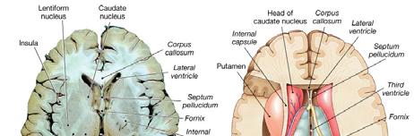 lentiform nucleus The globus palidus The putamen Motor and Sensory areas of the Cortex The
