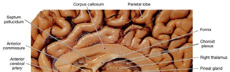 The Limbic System The limbic system includes nuclei and tracts along the border between the cerebrum and
