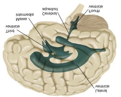 Cerebrospinal Fluid The brain floats in a pool of cerebrospinal fluid (CSF) which reduces its net weight from 1400 g --> 80 g CSF is also contained within four brain ventricles CSF is produced by