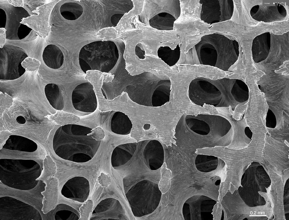 Low-power scanning electron microscope image of normal bone architecture in the 3 rd lumbar vertebra of a