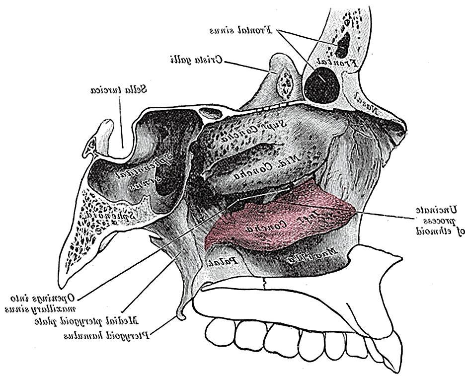 Figure 2: Lateral view of maxilla with windows cut in lateral and medial walls of maxillary sinus Frontal sinus Pyramidal process palatine bone Surgical Anatomy Bony anatomy Crista galli Sella