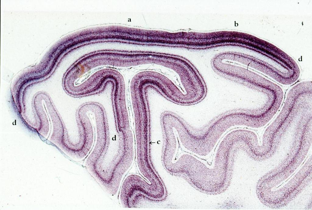 Gray matter, White matter Gray matter (stained purple): folded sheet containing cell