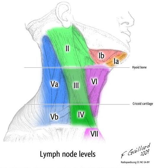 Classification of cervical lymph nodes (LN) 1- submental submandibular 2- upper cervical above the level of hyoid bone along the internal jugular chain 3-middle cervical between the level of hyoid