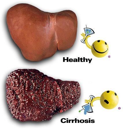 Healthy Liver