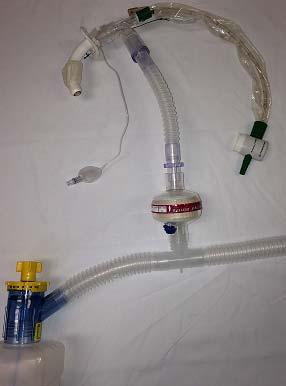 Figure 2 Oxymask Non-ventilated patients with tracheostomy or endotracheal tubes frequently require humidified oxygen or air.