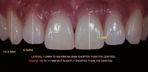 8 9 10 Figure 8-10: Acceptable width-to-length ratios fall between 70% and 85%, with the ideal range between 80% and 85%. the central incisor.