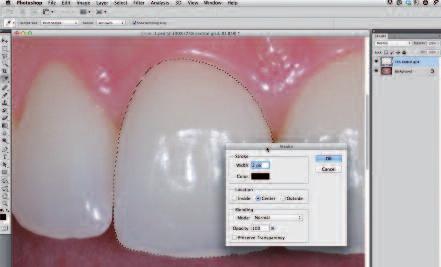 attractive smile in Photoshop and create a separate transparent