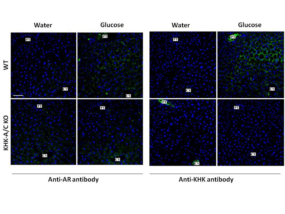 Supplementary Figure S7. Hepatic distribution of AR and KHK in control and glucose-fed mice.