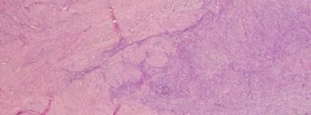 overlying glands in the endometrium