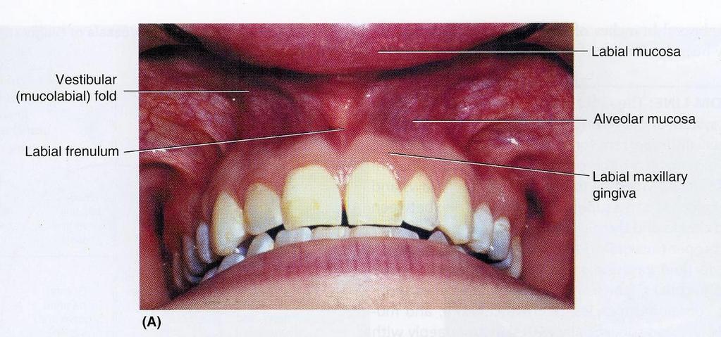 ORAL CAVITY The mouth extends from lips to oropharyngeal isthmus (the