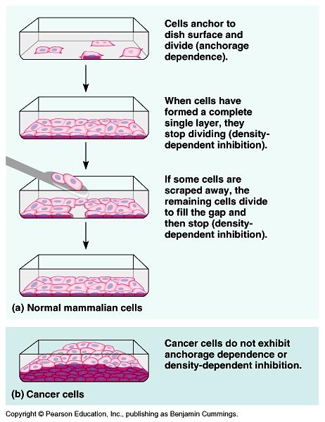 Cancer cells divide and invade tissues.