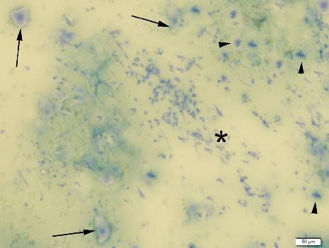 101 Figure 3: Control group 7. Day gingival swap May Grunwald-Giemsa stain, angiogenesis (arrow), collagen (*), leukocyte (arrowhead).