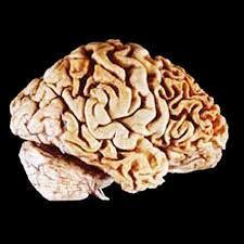 functions) Frontemporal Dementia Damage (atrophy) of frontal lobe