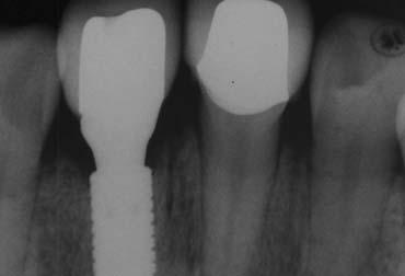 Radiograph after  01.